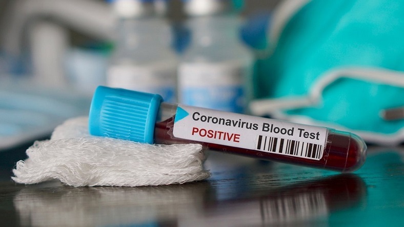 koronavirüs testi